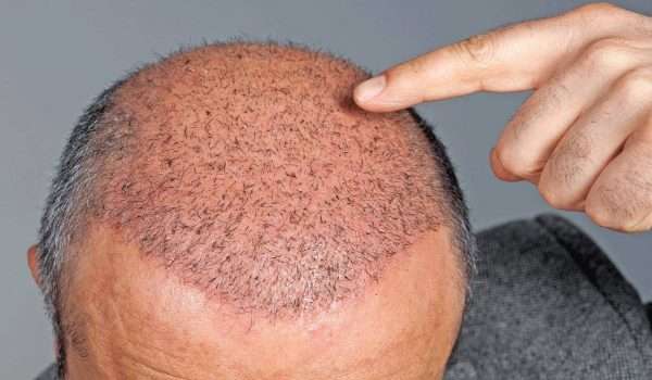 ÙØªÙجة Ø¨ØØ« Ø§ÙØµÙر ع٠عÙ
ÙÙØ© زراعة Ø§ÙØ´Ø¹Ø±