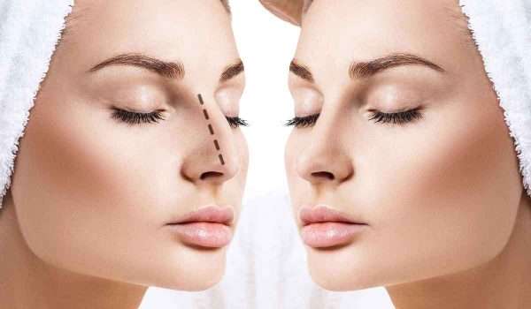 نتائج-عملية-تجميل-الانف1